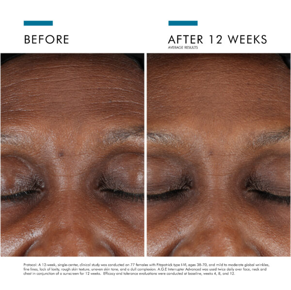 SkinCeuticals A.G.E. Interrupter Advanced - Image 4