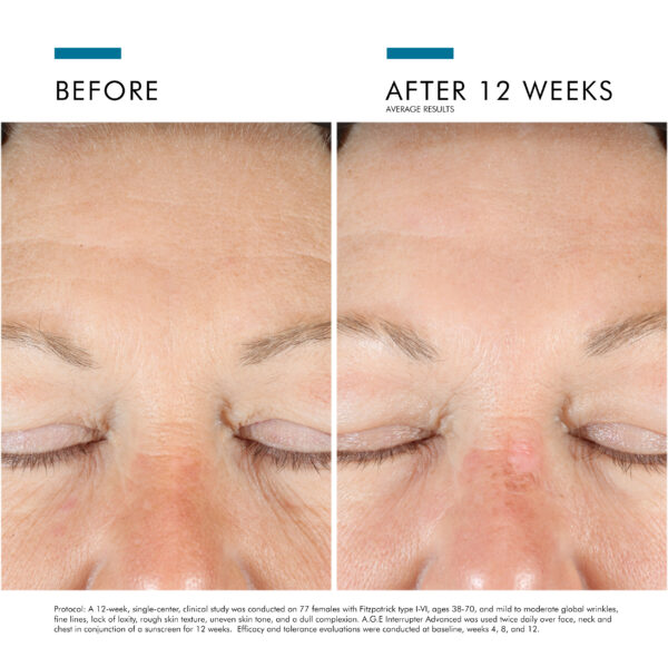SkinCeuticals A.G.E. Interrupter Advanced - Image 5