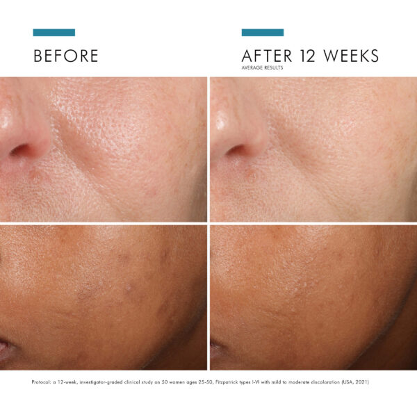 SkinCeuticals Phloretin CF - Image 7