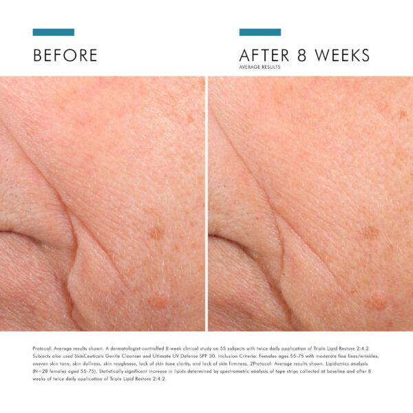 SkinCeuticals Triple Lipid Restore - Image 5