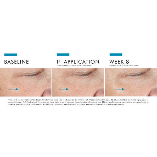 SkinCeuticals A.G.E. Advanced Eye - Image 4