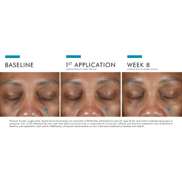 SkinCeuticals A.G.E. Advanced Eye - Image 6