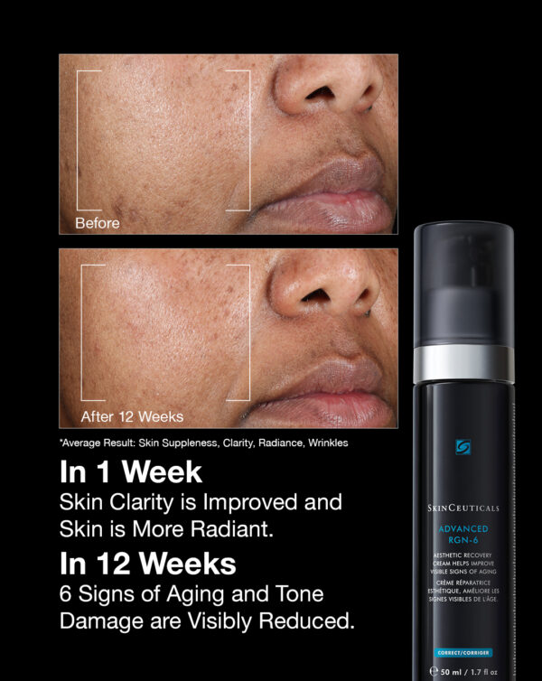 SkinCeuticals Advanced RGN-6 - Image 5