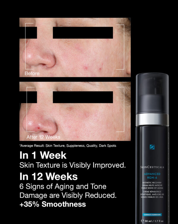 SkinCeuticals Advanced RGN-6 - Image 6