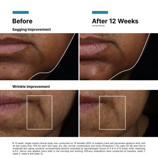 SkinCeuticals AGE Interrupter Ultra Serum - Image 6